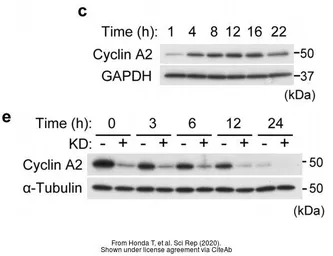 Anti-Cyclin A2 antibody used in Western Blot (WB). GTX103042