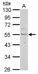 Anti-Cyclin A2 antibody used in Western Blot (WB). GTX103042