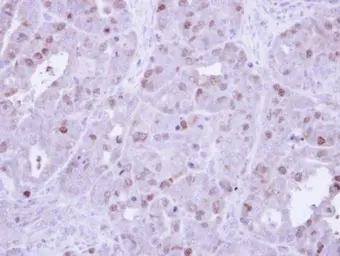 Anti-Cyclin A2 antibody used in IHC (Paraffin sections) (IHC-P). GTX103042