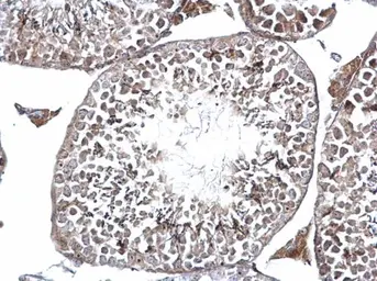 Anti-DMC1 antibody [N1C1] used in IHC (Paraffin sections) (IHC-P). GTX103062