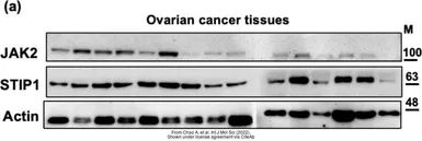 Anti-STIP1 antibody used in Western Blot (WB). GTX103068