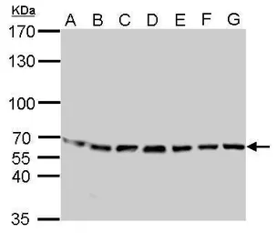 Anti-STIP1 antibody used in Western Blot (WB). GTX103068