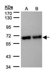 Anti-STIP1 antibody used in Western Blot (WB). GTX103068
