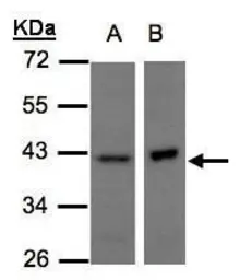 Anti-NDUFA10 antibody [N1C3] used in Western Blot (WB). GTX103093
