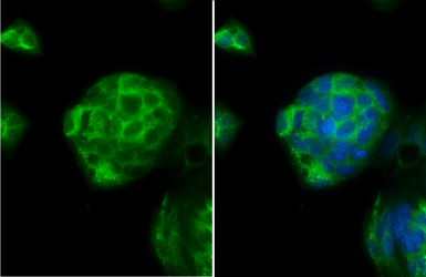 Anti-Interferon gamma Receptor 1 antibody used in Immunocytochemistry/ Immunofluorescence (ICC/IF). GTX103098