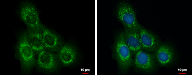 Anti-INPP5F antibody used in Immunocytochemistry/ Immunofluorescence (ICC/IF). GTX103107