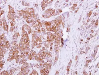 Anti-INPP5F antibody used in IHC (Paraffin sections) (IHC-P). GTX103107