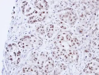 Anti-DNA ligase III antibody used in IHC (Paraffin sections) (IHC-P). GTX103172