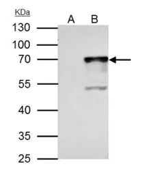 Anti-NRF1 antibody used in Immunoprecipitation (IP). GTX103179