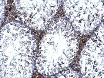 Anti-TrxR1 antibody [N1N3] used in IHC (Paraffin sections) (IHC-P). GTX103202