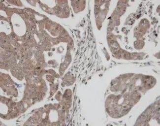 Anti-TrxR1 antibody [N1N3] used in IHC (Paraffin sections) (IHC-P). GTX103202
