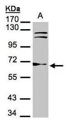 Anti-TrxR1 antibody [N1N3] used in Western Blot (WB). GTX103202