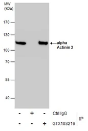 Anti-alpha Actinin 3 antibody used in Immunoprecipitation (IP). GTX103216