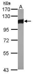 Anti-alpha Actinin 3 antibody used in Western Blot (WB). GTX103216