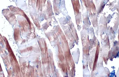 Anti-alpha Actinin 2 antibody [N1N3] used in IHC (Paraffin sections) (IHC-P). GTX103219