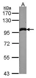 Anti-alpha Actinin 1 antibody [N2N3] used in Western Blot (WB). GTX103240