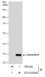 Anti-Annexin IV antibody used in Immunoprecipitation (IP). GTX103249