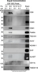 Anti-Annexin V antibody used in Western Blot (WB). GTX103250