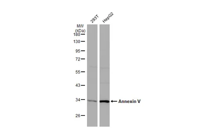 Anti-Annexin V antibody used in Western Blot (WB). GTX103250
