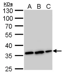 Anti-Annexin V antibody used in Western Blot (WB). GTX103250