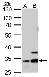 Anti-Annexin V antibody used in Western Blot (WB). GTX103250