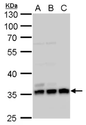 Anti-Annexin V antibody used in Western Blot (WB). GTX103250