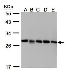 Anti-Rho GDI2 antibody [N1C3] used in Western Blot (WB). GTX103254