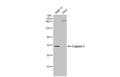 Anti-Calpain 5 antibody [N1C1] used in Western Blot (WB). GTX103264