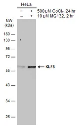 Anti-KLF5 antibody used in Western Blot (WB). GTX103289