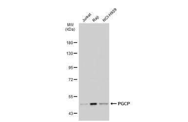 Anti-PGCP antibody used in Western Blot (WB). GTX103290