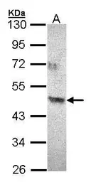 Anti-ACAD8 antibody [N3C3] used in Western Blot (WB). GTX103305