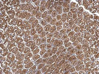 Anti-Arp2 antibody [N1C3] used in IHC (Paraffin sections) (IHC-P). GTX103311