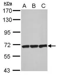 Anti-T-Plastin antibody used in Western Blot (WB). GTX103323