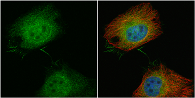 Anti-T-Plastin antibody used in Immunocytochemistry/ Immunofluorescence (ICC/IF). GTX103323