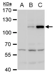 Anti-Dengue virus NS5 protein antibody used in Western Blot (WB). GTX103350