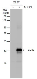 Anti-CCN3 antibody used in Western Blot (WB). GTX103377