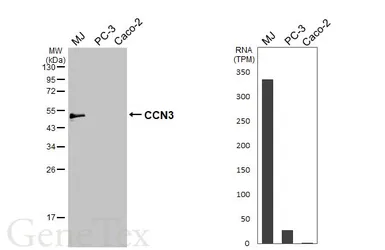 Anti-CCN3 antibody used in Western Blot (WB). GTX103377
