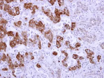 Anti-ALDH6A1 antibody used in IHC (Paraffin sections) (IHC-P). GTX103405
