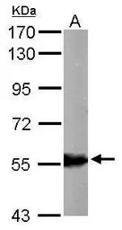 Anti-ALDH6A1 antibody used in Western Blot (WB). GTX103405