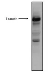 Anti-beta Catenin antibody, Internal used in Western Blot (WB). GTX10342