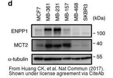 Anti-ENPP1 antibody [N2C2], Internal used in Western Blot (WB). GTX103447