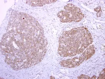 Anti-tPA antibody used in IHC (Paraffin sections) (IHC-P). GTX103453