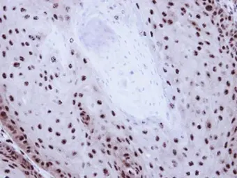 Anti-GABPB1 antibody [N1C3] used in IHC (Paraffin sections) (IHC-P). GTX103464