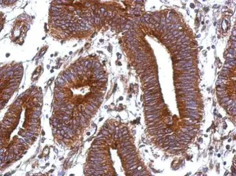 Anti-Vitronectin antibody used in IHC (Paraffin sections) (IHC-P). GTX103475