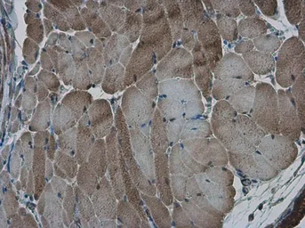 Anti-AMPK alpha 2 antibody used in IHC (Paraffin sections) (IHC-P). GTX103487