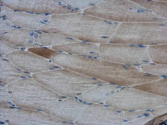Anti-AMPK alpha 2 antibody used in IHC (Paraffin sections) (IHC-P). GTX103487