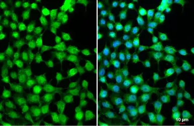 Anti-AMPK alpha 2 antibody used in Immunocytochemistry/ Immunofluorescence (ICC/IF). GTX103487