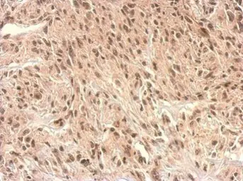 Anti-Monoglyceride lipase antibody used in IHC (Paraffin sections) (IHC-P). GTX103517