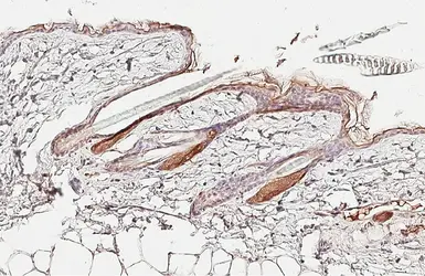 Anti-Kallikrein 7 antibody used in IHC (Paraffin sections) (IHC-P). GTX103548
