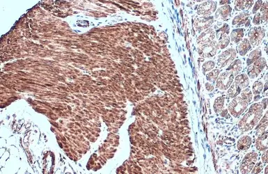 Anti-Desmin antibody used in IHC (Paraffin sections) (IHC-P). GTX103557